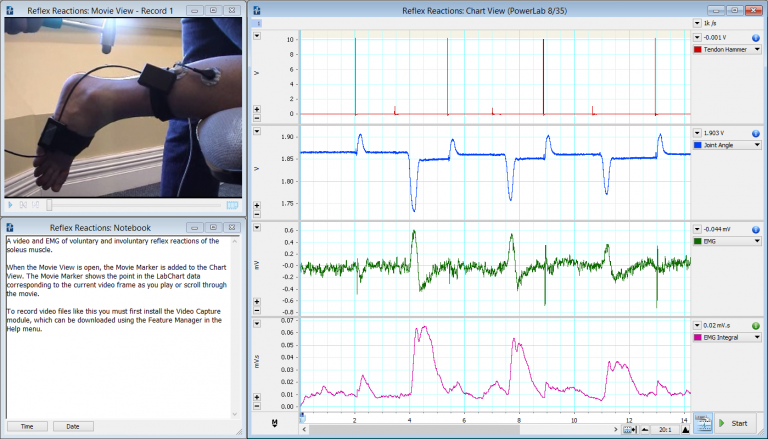 Video and EMG of voluntary and involuntary reflex reactions of the soleus muscle, using our goniometer and tendon hammer , and LabChart’s Video Capture Add-On .