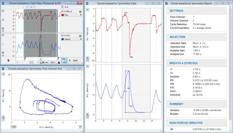 Forced exhalation data, flow-volume loops and Spirometry report produced using the Spirometry Add-On for LabChart.