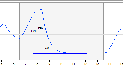 Spirometry