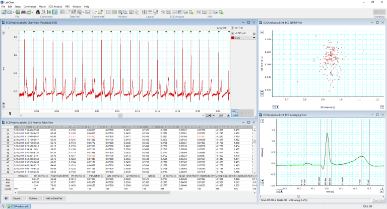 Using LabChart's ECG Analysis module on a human ECG recording