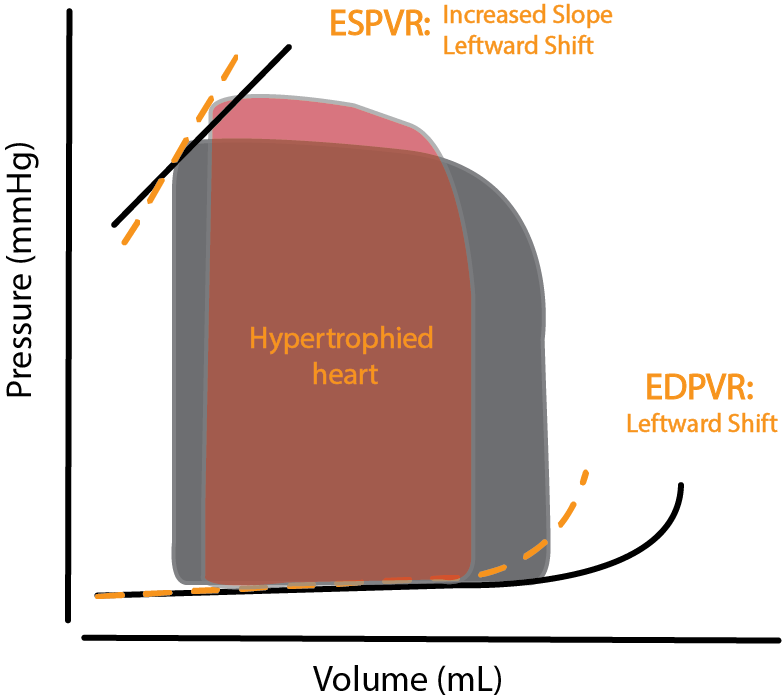 PV Loop of hypertrophied heart