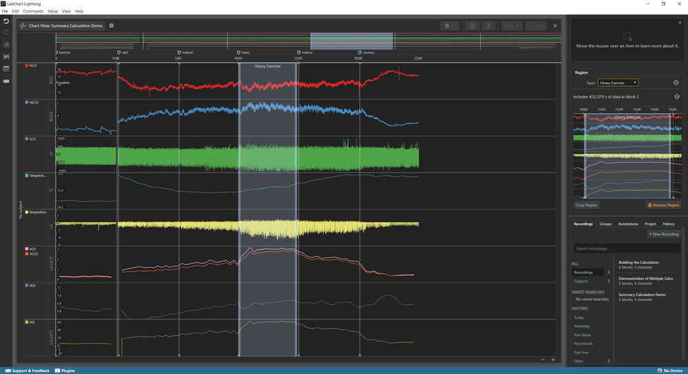 Resulting Channel calculation LabChart Lightning