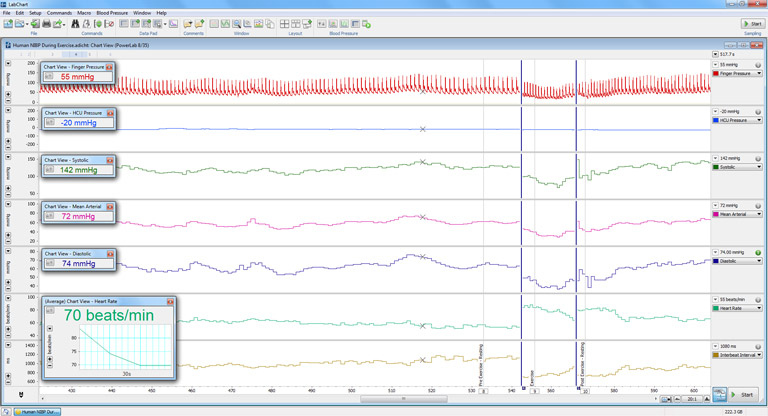 Blood Pressure signal recorded with ADInstruments' Human NIBP System