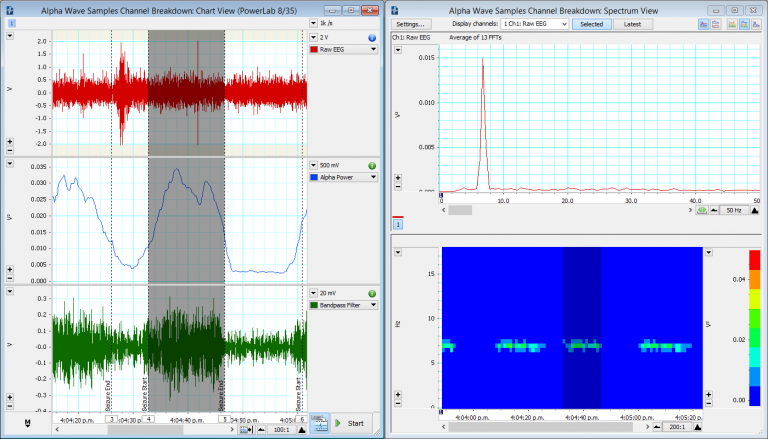 An EEG recording from a human being exposed to light stimuli. Alpha wave activity has been isolated using 2 different methods: 1) LabChart Spectrum and 2) Bandpass Filter.