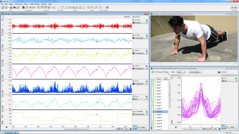 Wireless EMG analysis in LabChart.